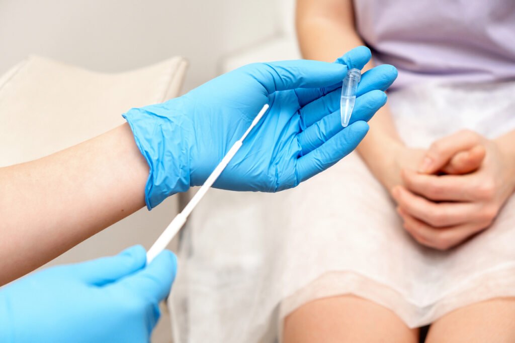 Genital enfeksiyon testlerinde kullanılabilen sürüntü çubuğu ve örnek tüpü.
