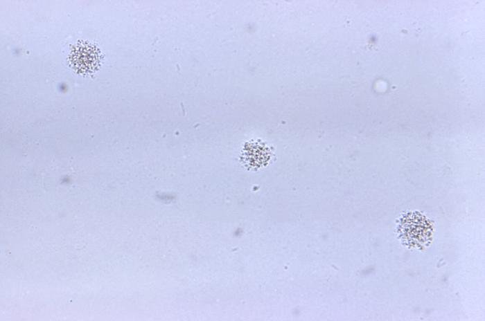 Ureaplasma urealyticum kolonilerinin 500 kat büyütülmüş mikroskop görüntüsü
