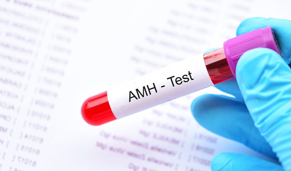 Yumurtalık rezervi değerlendirmesi için AMH testi örnek tüpü