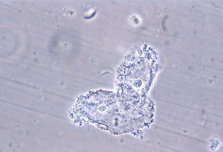 Bakteriyel vajinoziste yüzeyleri bakterilerle kaplı vajinal epitel hücreleri, clue cells