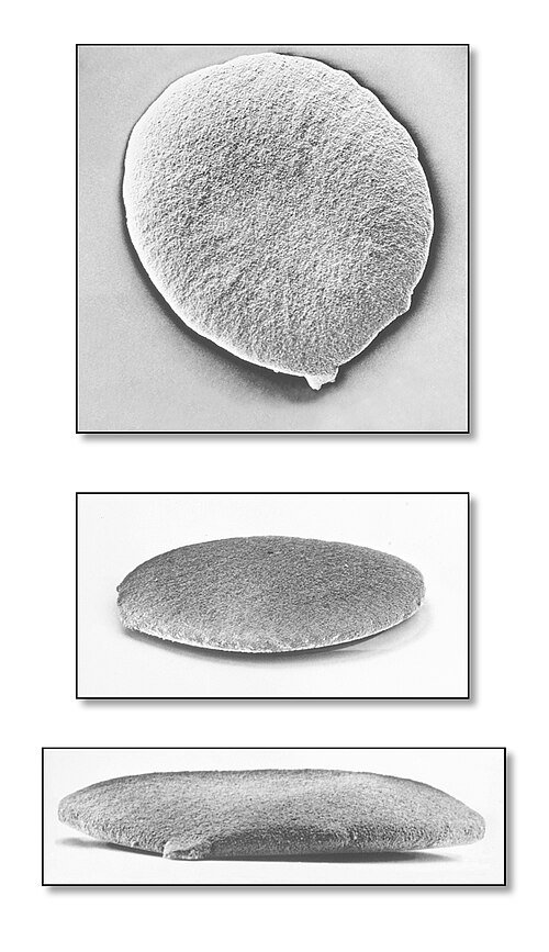 Gonore etkeni Neisseria gonorrhoeae bakterisinin taramalı elektron mikroskop görüntüsü