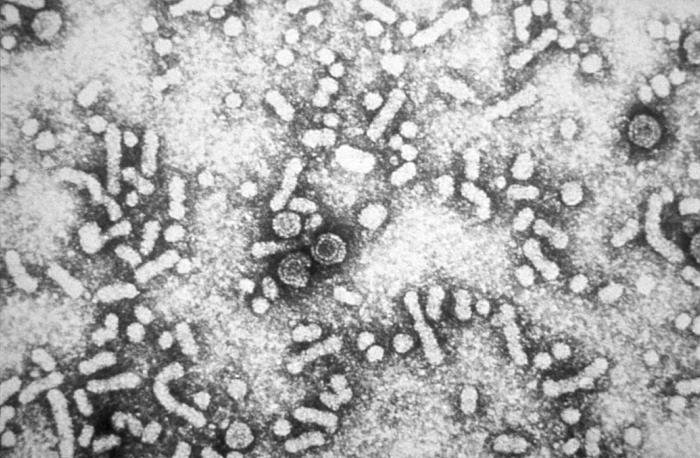 Hepatit B virüsünün Dane parçacıklarının elektron mikroskop görüntüsü