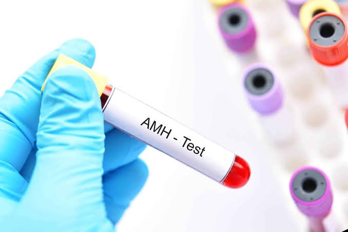 AMH testi için hazırlanmış kan örneği tüpü