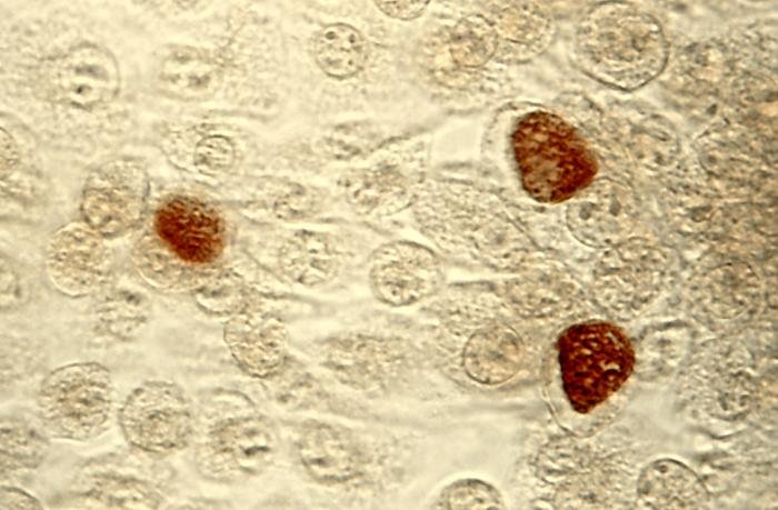 McCoy hücre kültüründe Chlamydia trachomatis inklüzyon cisimciklerinin mikroskop görüntüsü