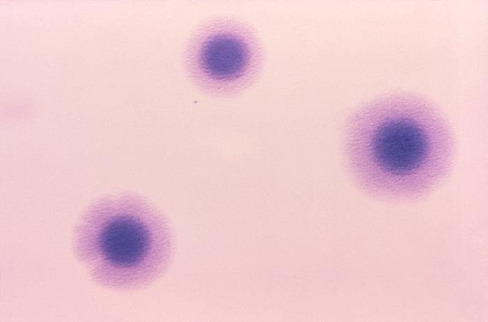 Mycoplasma hominis bakterisinin agarda sahanda yumurta görünümündeki mikrokolonileri