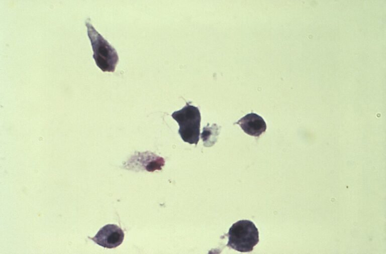 Giemsa boyamasıyla Trichomonas vaginalis parazitinin mikroskop görüntüsü